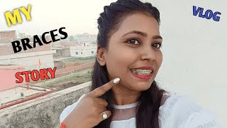 My Braces Journey My Braces Story 😊 ND Family Vlogs [upl. by Radmilla]