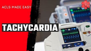 ACLS Tachycardia Algorithm [upl. by Ainuj]