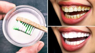 Hydrogen Peroxide Teeth Whitening  How To Get The Best Results [upl. by Eiba]