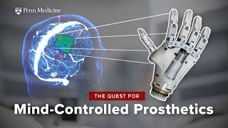 ThoughtControlled Prosthetics A BrainComputer Interface Breakthrough [upl. by Enilram]