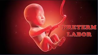 PRETERM LABOR  Define Causes Pathophysiology Diagnosis amp Management  Preterm Labor TOCOLYTICS [upl. by Cathlene]