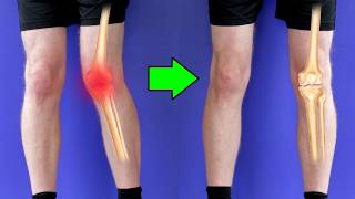 Knee Pain This Is DESTROYING Your Knees [upl. by Nayd]