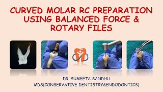 Curved molar root canal preparation using Balanced force tech amp rotary files Complete Molar RCT [upl. by Leoy]