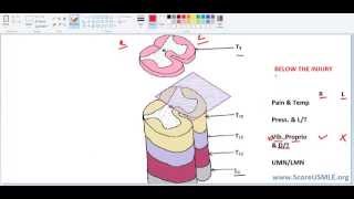 Spinal Pathways MADE SUPER EASY3 Final [upl. by Nelson]