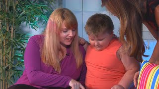 What are Treatment Options for PraderWilli Syndrome [upl. by Barrow]