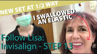 🦷 Follow Lisa Invisalign 13  New set of trays and attachments  and swallowing elastics [upl. by Irallih]