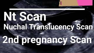 nt scan nt scan in 3 months pregnant nuchal translucency ultrasound 12 weeks [upl. by Guimar125]