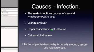 Cervical Lymphadenopathy [upl. by Liss]