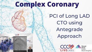 PCI of Long LAD CTO using Antegrade Approach [upl. by Nevet]