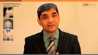 Dr Rajesh Shah explaining role of homeopathy for Eczema treatment [upl. by Ytirev26]