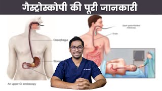 Is Gastroscopy Painful Cost Side Effects Safety Explained  Dr Vishal Tomar  Open Consult [upl. by Atlante]