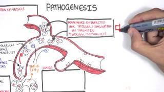 Malaria Pathophysiology [upl. by Bedell]