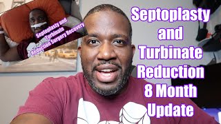 Septoplasty and Turbinate Reduction Surgery 8 Month Update  Deviated Septum Surgery [upl. by Gisella]