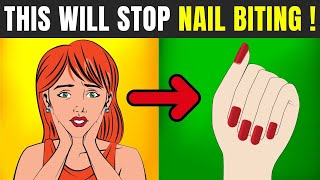 Do This For Nail Biting Habit  How To Stop Biting Your Nails From Day 1 [upl. by Melesa]