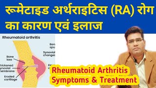 Rheumatoid Arthritis Cause Symptoms Diagnosis and Treatment  in Hindi [upl. by Ydaj591]