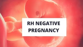 Rh negative pregnancy [upl. by Ricarda]