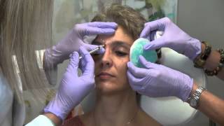 What is Botox and How Does it Work [upl. by Arratoon814]