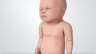 Infant Distress Warning Signs Grunting Baby Sound [upl. by Solracesoj]