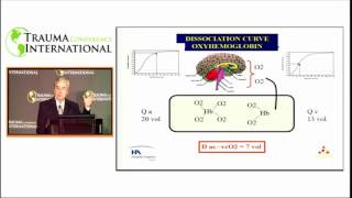 Postresuscitation Injury  A Brain Point of View English [upl. by Enaywd428]