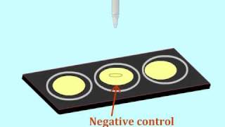 Agglutination assay to detect antigens  MultiLingual Captions [upl. by Oirotciv]