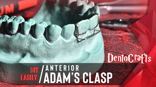 DIY EASILY ANTERIOR ADAMS CLASP  PRECLINICAL ORTHODONTICS  DENTISTRY [upl. by Bocaj53]