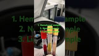 Difference between normal  hemolyzed and lipemic sample labinfo2 science facts shorts short [upl. by Rovert911]