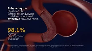 Pipeline Flex with Shield Technology – Shielded by Science [upl. by Tad]