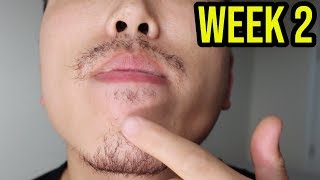 ASIAN BEARD GROWTH USING MINOXIDIL WEEK 2 RESULTS [upl. by Ahsial]