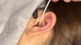 ASMR Ear Cleaning  Satisying Earwax Removal Experience [upl. by Belter]