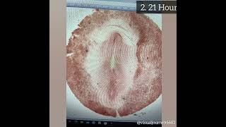 Study Of Developmental Stages Of Chick through Permanent Slides Chick Embryo Chick Egg [upl. by Duyne740]