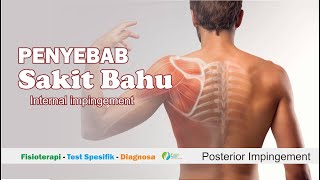 Pemeriksaan Bahu  Posterior Impingement Sign  Peradangan Otot Posterior [upl. by Ja]