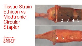 Comparison of Bunching During Device Closing  JampJ MedTech [upl. by Van]