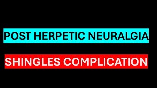 POST HERPETIC NEURALGIA [upl. by Peterec]