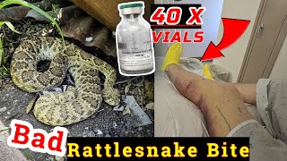 Rattlesnake Bite While Herping Central Texas [upl. by Weismann]