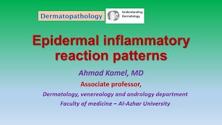 Epidermal inflammatory reaction patterns Dermatopathology [upl. by Leval696]