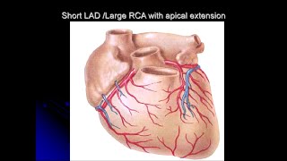 CORONARY ANGIOGRAPHIC VIEWS AND SYNTAX SCORE  BS Nguyễn Thanh Nhựt [upl. by Esirehs]