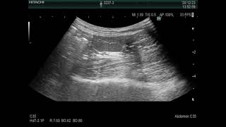 Echo images of the subcutaneous and the Intraabdominal cryptorchidism in dogs and a cat 犬猫の陰睾） [upl. by Bajaj834]