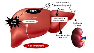 N Acetylcysteine NAC Supplement  Immune System Support Antioxidant Anti inflammatory [upl. by Lisette]