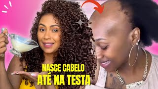 O cabelo cresce loucamente e não cai 3 ingredientes poderosos para o crescimento EXTREMO do cabelo [upl. by Yecnuahc444]