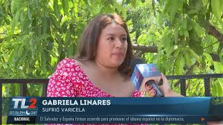 Varicela en adultos [upl. by Mloc]