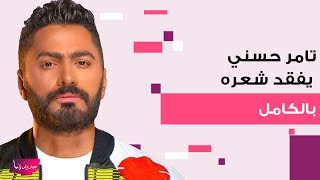 تامر حسني يفقد شعره بالكامل و هنا الزاهد تهاجمه بكلمات قاسية [upl. by Linsk]