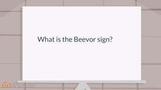 What is the Beevor sign [upl. by Alya274]