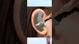 Asmr Ear Cleaning And Treatment Animation shorts asmr Animation [upl. by Britteny]