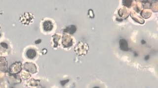 Spirochetes in Urine [upl. by Bonni]