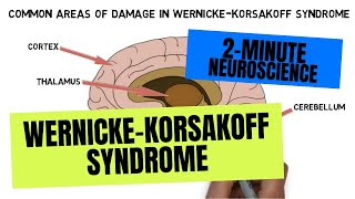 2Minute Neuroscience WernickeKorsakoff Syndrome [upl. by Aviva254]