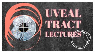 UVEAL TRACT lecture 8 TUBERCULOUS UVEITIS made easy [upl. by Drofnil]