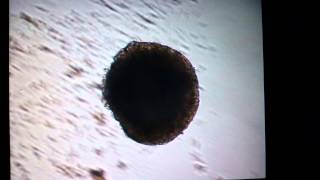 Beating 10 day old embryoid body from mES cells [upl. by Hurlbut344]