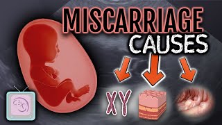 Dr Morris Ultimate Guide to Recurrent Miscarriage Testing [upl. by Asiar]