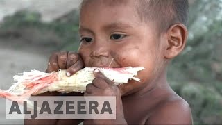 Venezuelans face severe food shortage [upl. by Eedolem]