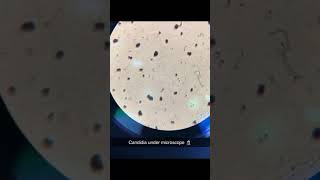 Gram stainBacteria Gcocci and fungi candida under microscope [upl. by Grobe3]